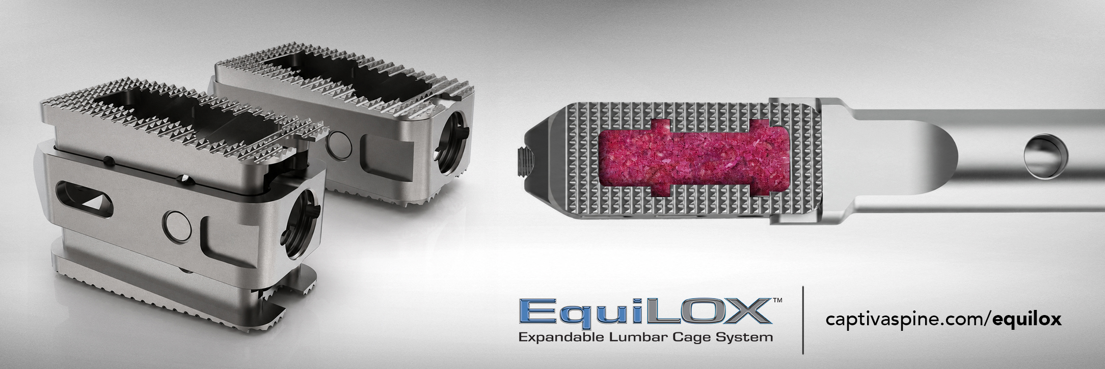 Captiva Spine EquiLOX Lordotic TLIF PLIF expandable lumbar cage
