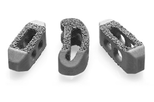 Captiva Spine TirboLOX-L Titanium Lumbar Cage TLIF PLIF