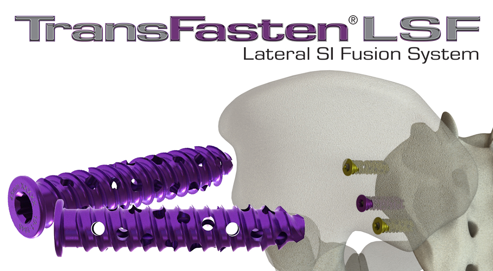 ASC-Ready TransFasten-LSF Lateral SI Fusion System - Bone Screw