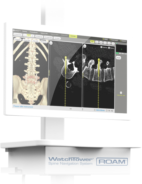 Spine Navigation Instruments Captiva Spine | Spine Navigation, SI Fusion, and Spinal Implants