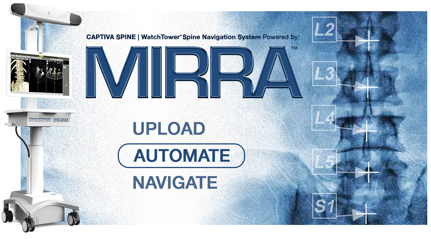 WatchTower spine navigation system powered by MIRRA
