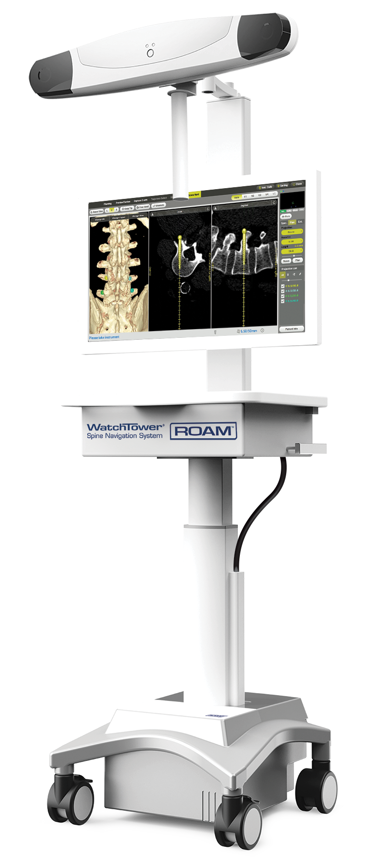 WatchTower-ROAM-Spine-Navigation-System-Mirra-2D-3D